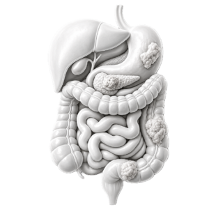 DIGESTIVE SYSTEM TUMORS